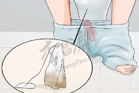 痔疮最佳的自愈方法04.jpg